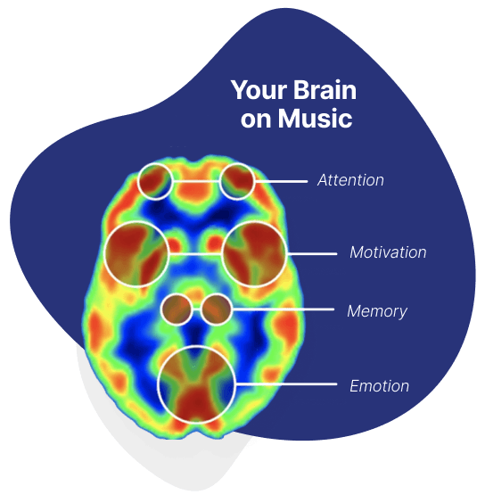 Music on the Brain